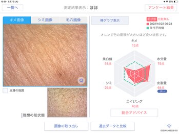 Rr.FACIAL郡山店　毛穴×たるみ×小顔専門店/