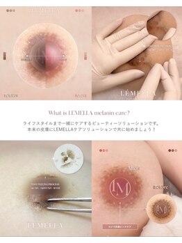 フリュール(FLEUR)/ルメラメラニンケア☆黒ずみケア