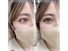 イルミン(irumin)/まつ毛パーマ