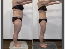 リリーパッソ(Lily passo)/beforeAfter