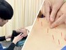 【自律神経調整】　全身整体&矯正+鍼灸 90分　14520円→8800円