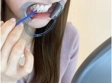 エクシアホワイトニング 六本木店の雰囲気（蓄積された汚れはコスパ抜群のエクシアで白い歯に！）