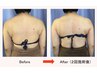 人気No6【脂肪とおさらば!】全身本気痩せ★最新痩身の組合わせ10,000円