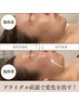 【ブライダル】ブライダルカウンセリング　30分当日体験あり