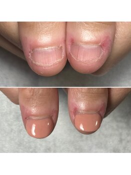 荒れた指先も見違えるほど綺麗に