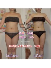 ボディグロス 梅田店(BODY GLOSS)/VIPセレブ10回ー8.7kg