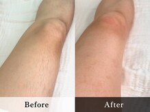 メンズオージー 岡山中区(men's O.G)/メンズ脱毛｜あし脱毛