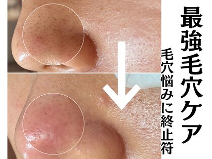 リアン(LIAN)の写真