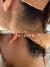 アトリーチェ ベレッツァ(ATTRICE Bellezza)/全身脱毛