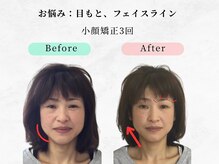 ウェリナ 一宮院/小顔矯正/骨盤矯正/痩身整体