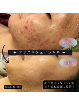 美山堂/肌荒れにお悩みの方必見