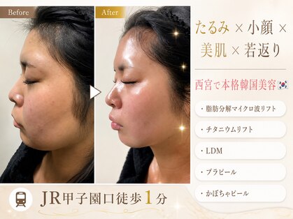 サロン エマ(salon emma)の写真