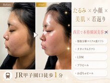 サロン エマ(salon emma)