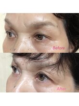 イーストアッカ アイラッシュ(East AkkA eyelash)/まつ毛エクステで目元エイジング