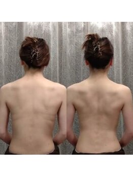 ロゼッタビューティー(Rosetta Beauty)/ブライダルエステのBeforeAfter