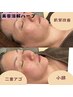 【二重アゴ/小顔/肌質改善】小顔美肌美容溶解ハーブ3gトリートメント
