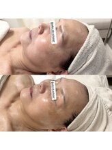 サロン ド シューナ(salon de schoner)/STEP UPケア【お得な回数券有】