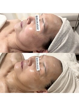 サロン ド シューナ(salon de schoner)/STEP UPケア【お得な回数券有】