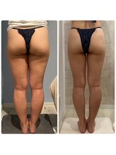 ルナグランデ 心斎橋店(Luna grande.)/回数を重ねることで別人級に