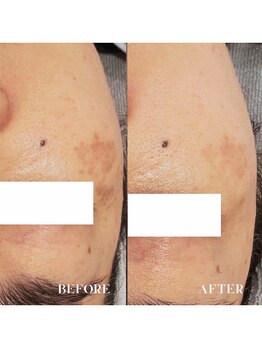 スローティ ラテ 三沢店/