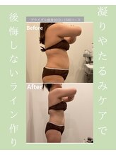 メゾンワン(maison one)/花嫁ボディメイク記