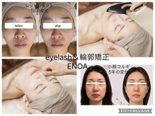 エノア(ENOA)