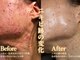 エレ(ele)の写真
