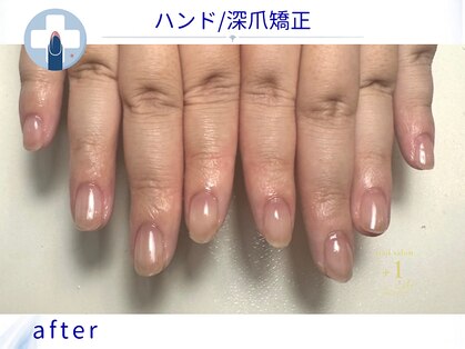 プラスワン(+1)の写真