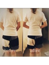 フィジオリハ 久屋大通店/美容筋膜リリース～ウエスト～