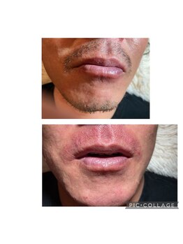 サロン ド ソレイユ(Salon.de.Soleil)/