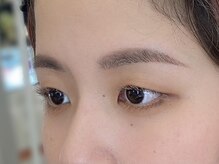 ビューティーガーデン イース/AFTER