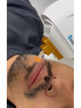 メディカルサロン ティアラ 亀有本店/【脱毛】メンズ/デザインヒゲ