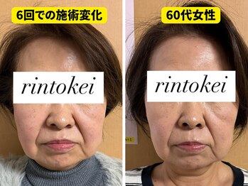 凛と慶/長居-美容鍼・ダイエット