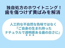 ホワイトニングカフェ 中野店(WhiteningCafe)/◎ホワイトニングカフェ