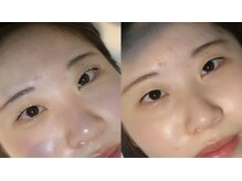 モアナ バイ ヘッドライト 三島店(Moana by HEADLIGHT)/ラッシュリフト