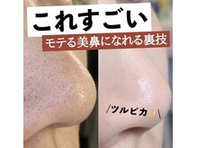 ロミエール(LOMIERE)/毛穴ケア