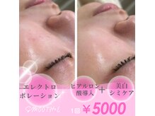 スムース イー(Smooth+E)の雰囲気（大人気エレクトロポレーションで毛穴もたるみも引締め肌質改善◎）