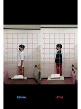 ミナト整骨院/猫背&自律神経改善整体　Iさん2