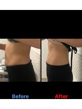 ガネェーシャ(Ganesha)/気になる部分・皮膚の引き締めに