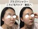 タマ メディカルビューティー 恵比寿(TAMA Medical Beauty)の写真