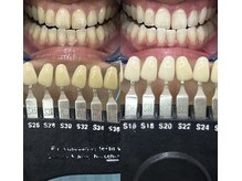 トウキョウスワーズ 池袋店(TOKYO SWRS)/#ホワイトニング #池袋 #渋谷
