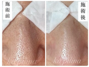 カピリナ(ka pilina)/★加工なしのリアルなお写真★