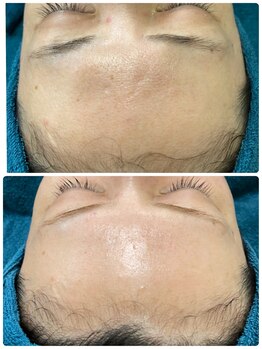 ソリッジ肌管理室/シミケア・くすみケア