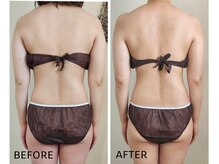 肩と背中のもっこり肉を撃退！一回り小さい後姿に