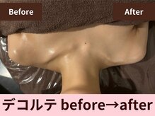 クイーンズチャーム(Queen's Charm)/デコルテ・首肩の変化★