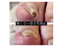 ロッティ(Lottie)の雰囲気（爪に優しい巻き爪矯正月1回・数回で理想の爪に♪）
