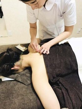 【女性専用完全個室】ひまわり鍼灸治療院 肩こり/腰痛/姿勢改善/美容鍼の写真/女性専用◆体の中から整える鍼治療院!独自の整体で深部までアプローチ。続けるほどに体のベースを底上げ◎