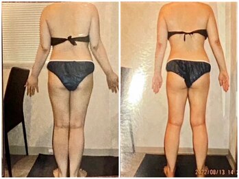 パーフェクトボディプレミアム 名古屋栄店(PERFECT BODY PREMIUM)/お客様 ビフォーアフター(26)