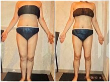 【61.8→56.8kg】下半身の脂肪にお悩みの方の成功事例をご紹介◎