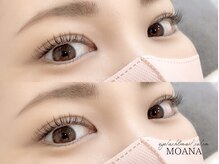 アイラッシュサロンモアナ 梅田芝田店(MOANA)/LEDエクステ120本